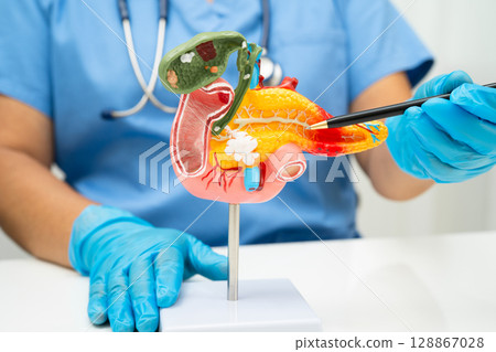 Pancreatitis, pancreatic cancer, Asian doctor with pancreas, gallbladder and bile duct human anatomy model at hospital. 128867028