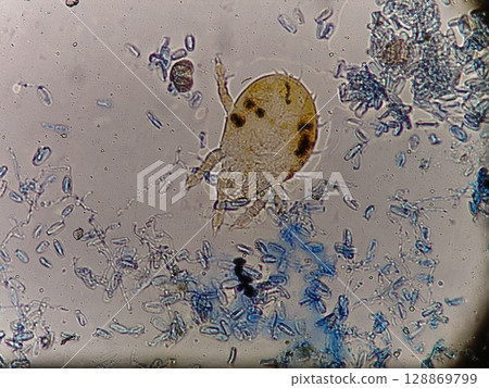 Mites captured together with mold 128869799