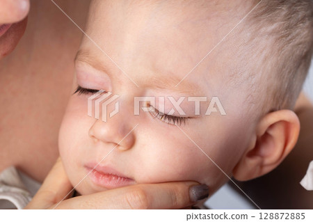 Face of little boy with closed sore eyes with conjunctivitis. Concept of infectious eye diseases in children, close-up Face of little boy with closed sore eyes with conjunctivitis. Concept of infectious eye diseases in children, close-up 128872885