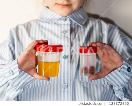 A child holds a urine and stool test in his hands. The concept of testing children for infections, close-up A child holds a urine and stool test in his hands. The concept of testing children for infections, close-up 128872890