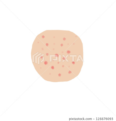 Rash | Illustration material of spot-like changes appearing on the skin (transparent PNG) Rash Skin Illustration 128876093