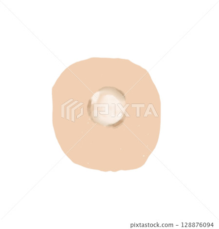 水泡 | 皮膚水泡插畫材料（透明PNG）水泡/囊泡插圖 128876094