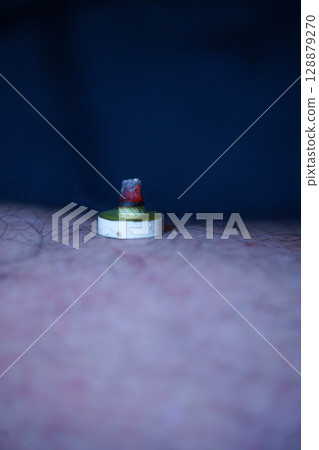 Moxibustion is a traditional Chinese medicine that stimulates acupressure points to improve physical condition. Moxibustion is a traditional Chinese medicine that stimulates acupressure points to improve physical condition. 128879270