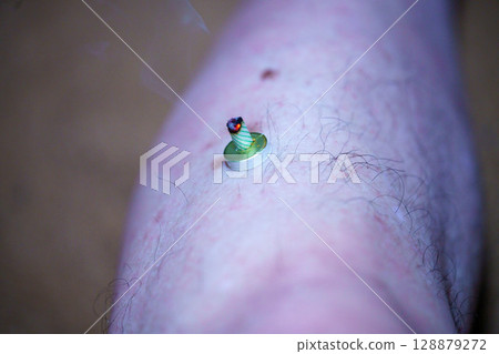 Moxibustion is a traditional Chinese medicine that stimulates acupressure points to improve physical condition. 128879272