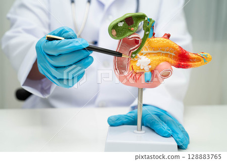 Liver with gallbladder, pancreas spleen and duodenum, Asian doctor holding human anatomy model for study diagnosis and treatment in hospital. Liver with gallbladder, pancreas spleen and duodenum, Asian doctor holding human anatomy model for study diagnosis and treatment in hospital. 128883765