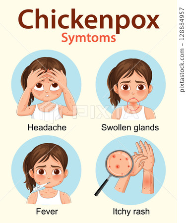 Chickenpox Symptoms Illustrated in Children with Visual Icons 128884957