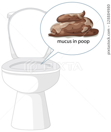 Toilet Illustration with Mucus in Stool Detail 128884980