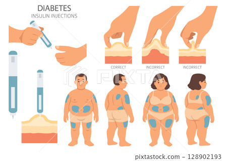 Diabetes. Endocrine diseases. Medical infographic design 128902193