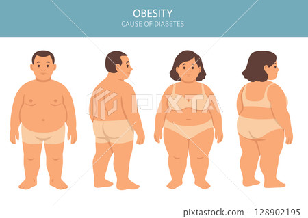 Flat vector illustration of weight loss concept. Before and after body transformation of overweight man and woman 128902195