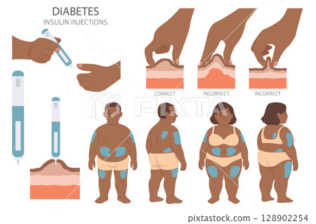 Diabetes. Endocrine diseases. Medical infographic design 128902254