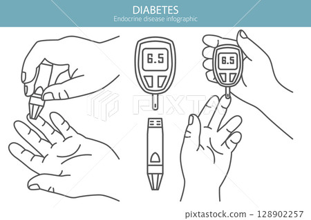 Diabetes. Endocrine diseases. Medical infographic design 128902257