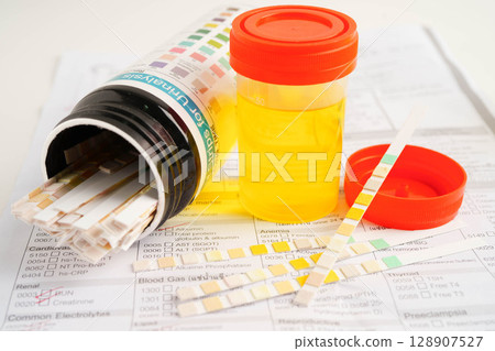 Urinalysis, urine cup for check health examination in laboratory. 128907527