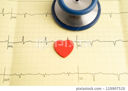 Stethoscope on electrocardiogram ECG, heart wave, heart attack, cardiogram report. 128907528