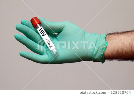 Man hand holding HIV test with glove 128910764