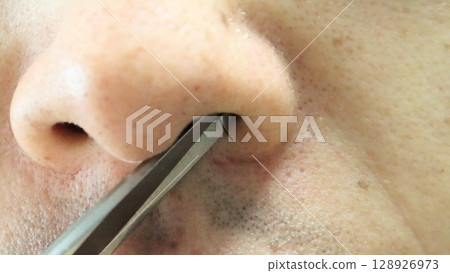 A person cutting an overgrown nose hair A person cutting an overgrown nose hair 128926973