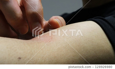 抓抓手臂上蚊蟲叮咬處的人 128926980
