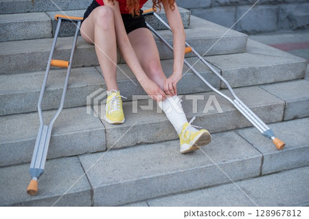 Girl with leg injury sits on the stairs with crutches. Girl with leg injury sits on the stairs with crutches. 128967812