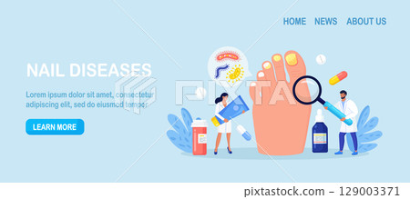Onychomycosis. Nail disease, fungal nails infection. Doctors exam and treat nails psoriasis. Doctor dermatologist analyzes psoriatic toenails. Paronychia. Inflammation of the skin around toenail 129003371