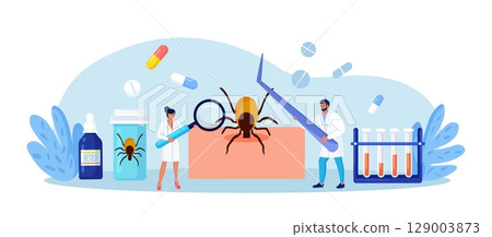 Prevention of Lyme, Encephalitis Diseases. Removing Encephalitis Ticks. Parasite Carrying Disease. First Aid with Infections Transmitted by Mites. Tick grabbed into skin, it is removed with tweezers 129003873
