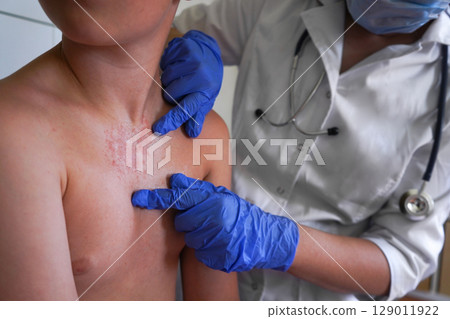 A doctor in blue gloves examines the rash on the boy's body. 129011922