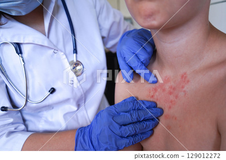 The doctor is examining the child's skin for signs of illness. 129012272