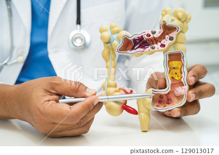 Intestine, appendix and digestive system, doctor holding anatomy model for study diagnosis and treatment in hospital. 129013017