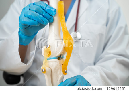 Osteoarthritis of the knee, Doctor holding human knee joint orthopedic anatomy model in hospital. Osteoarthritis of the knee, Doctor holding human knee joint orthopedic anatomy model in hospital. 129014361