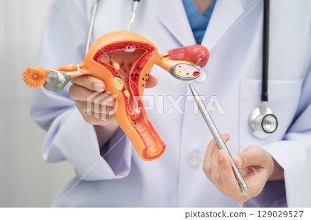 Uterus, doctor holding human anatomy model for study diagnosis and treatment in hospital. 129029527