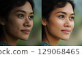 A young Asian woman with textured skin and severe acne is captured in natural light. She appears thoughtful, showcasing her unique beauty against a blurred green background. 129068465