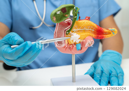 Pancreatitis, pancreatic cancer, Asian doctor with pancreas, gallbladder and bile duct human anatomy model at hospital. 129082024