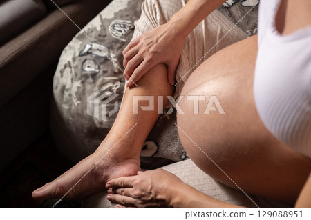 Pregnant woman with swelling on the legs, tired and pain in the legs, swelling during pregnancy. Varicose veins during pregnancy. Pregnant woman with swelling on the legs, tired and pain in the legs, swelling during pregnancy. Varicose veins during pregnancy. 129088951