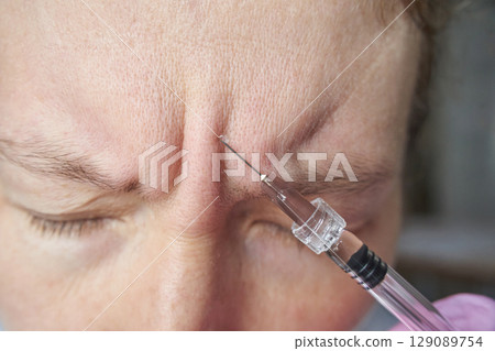 Caucasian adult female receiving forehead injection for cosmetic procedure 129089754