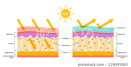 Sun protection skin scheme. Uv rays arrow penetrating, collagen destruction, structure damage, use lotions and creams, sunscreen protection, medical banner, nowaday vector isolated concept 129095065