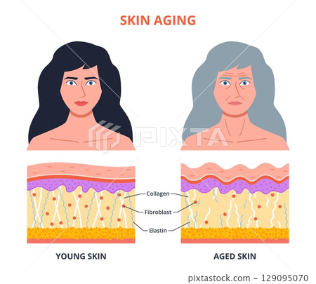 Aging process skin. Young, old woman portrait, structure changes, wrinkles, epidermis dehydration, elasticity loss, cartoon isolated female face, dermatology poster nowaday vector concept Aging process skin. Young, old woman portrait, structure changes, wrinkles, epidermis dehydration, elasticity loss, cartoon isolated female face, dermatology poster nowaday vector concept 129095070