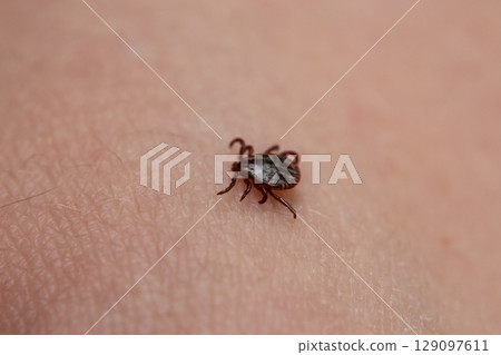 a tick crawls mite on a person's arm, close-up, macro a tick crawls mite on a person's arm, close-up, macro 129097611