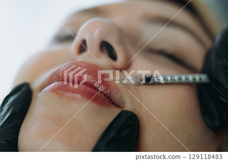 Precision Lip Enhancement: Professional Injectable Treatment in Progress Precision Lip Enhancement: Professional Injectable Treatment in Progress 129118483