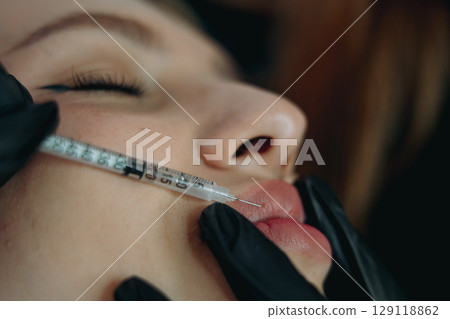 Precision Lip Enhancement: Professional Injectable Treatment in Progress Precision Lip Enhancement: Professional Injectable Treatment in Progress 129118862