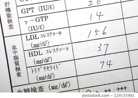 Abnormal cholesterol in a health checkup. Blood test results showing high LDL and low HDL. 129135981