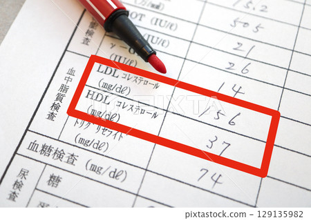 Abnormal cholesterol in a health checkup. Blood test results showing high LDL and low HDL. 129135982