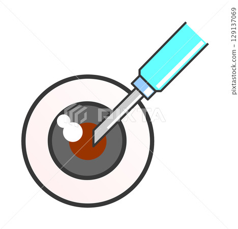 Illustration of eye disease caused by aging or disease, treated by surgery at an ophthalmology clinic 129137069