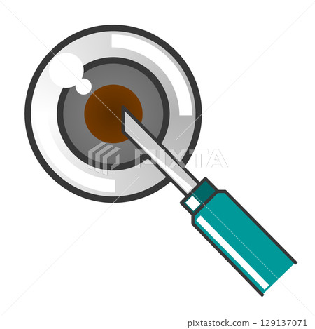 Illustration of eye disease caused by aging or disease, treated by surgery at an ophthalmology clinic Illustration of eye disease caused by aging or disease, treated by surgery at an ophthalmology clinic 129137071