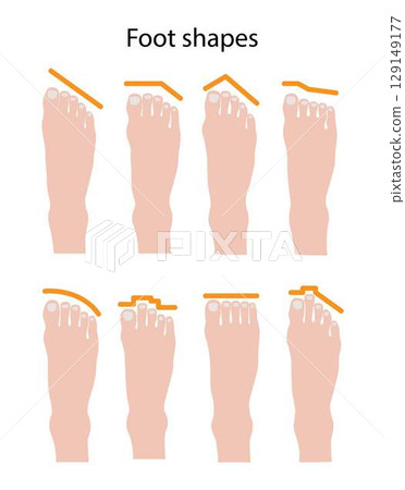 illustration of biology and physiology, Foot shapes, Human feet are highly individual, Arches are usually characterized as either low or flat, medium or high 129149177