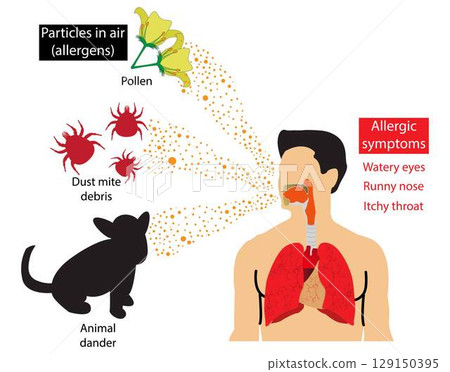 illustration of medical and Pollution, Symptoms of airborne allergies, Particles in air allergies, Allergies are caused by air poisoning from pollen and dust mites 129150395