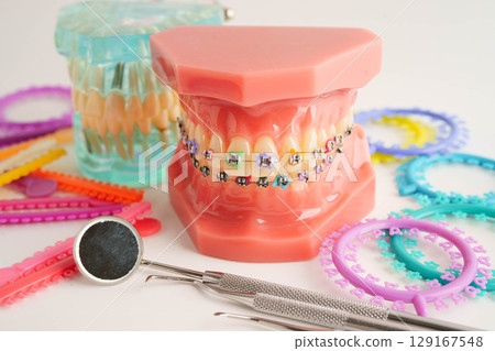 Orthodontic ligatures rings and ties, elastic rubber bands on orthodontic braces, model for dentist studying about dentistry. Orthodontic ligatures rings and ties, elastic rubber bands on orthodontic braces, model for dentist studying about dentistry. 129167548