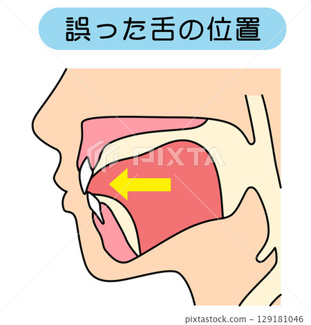 How to mew properly: correct and incorrect tongue position 129181046