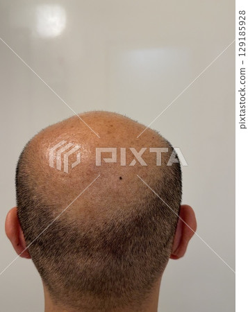 A thin hair man 129185928