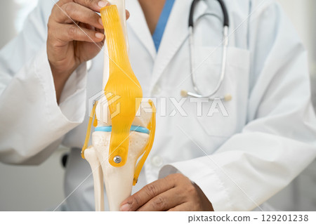 Osteoarthritis of the knee, Doctor holding human knee joint orthopedic anatomy model in hospital. 129201238