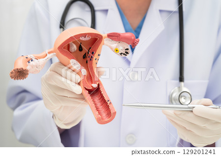 Uterus, doctor holding human anatomy model for study diagnosis and treatment in hospital. 129201241