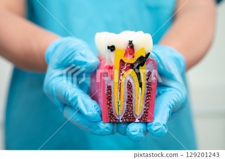Asian dentist holding dental implant, artificial tooth roots into jaw, root canal of dental treatment, gum disease, teeth model for dentist. 129201243