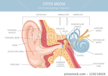 Otitis media. Infection in the middle ear. Otological disorders infographic Otitis media. Infection in the middle ear. Otological disorders infographic 129218826